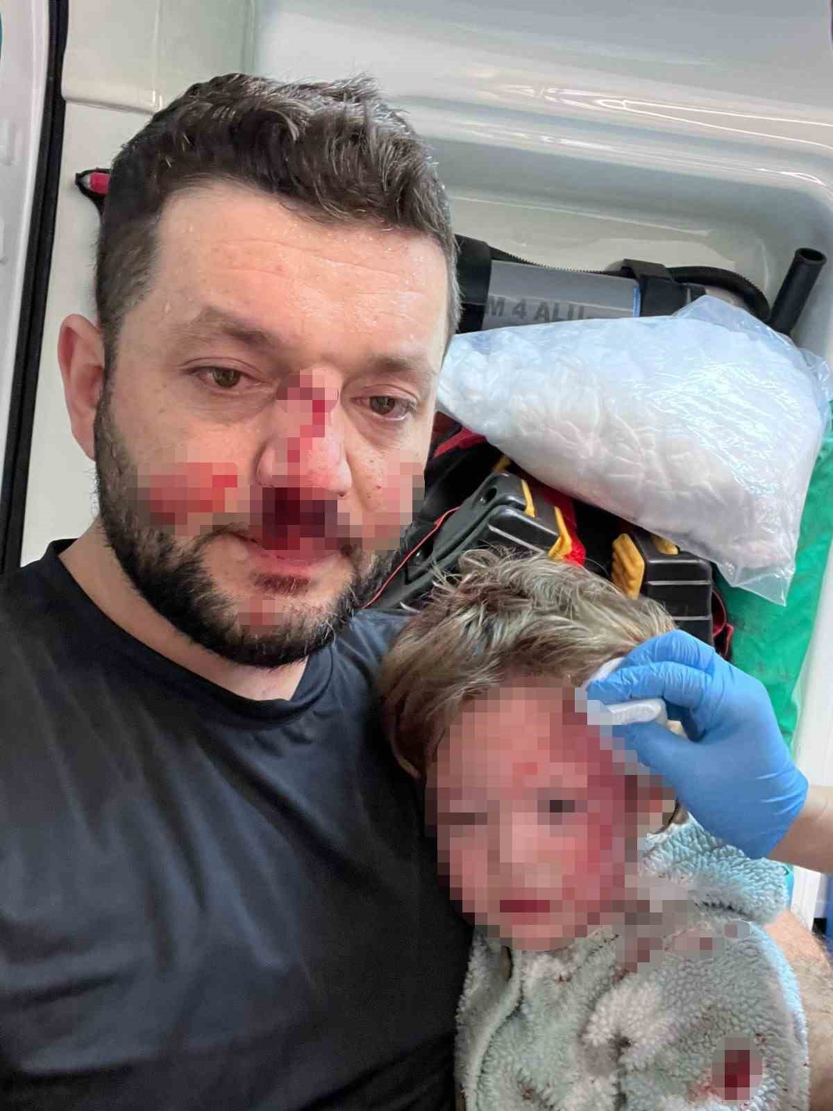 Yalova’da baba ve kızına scootterla saldıran sanığın yargılanması başladı
