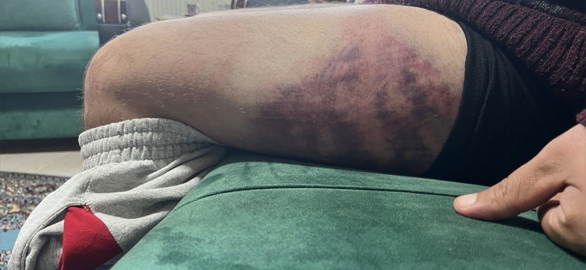 Yüzde 84 engeli bulunan adamı 30 dakika boyunca döven sanığın cezası belli oldu
