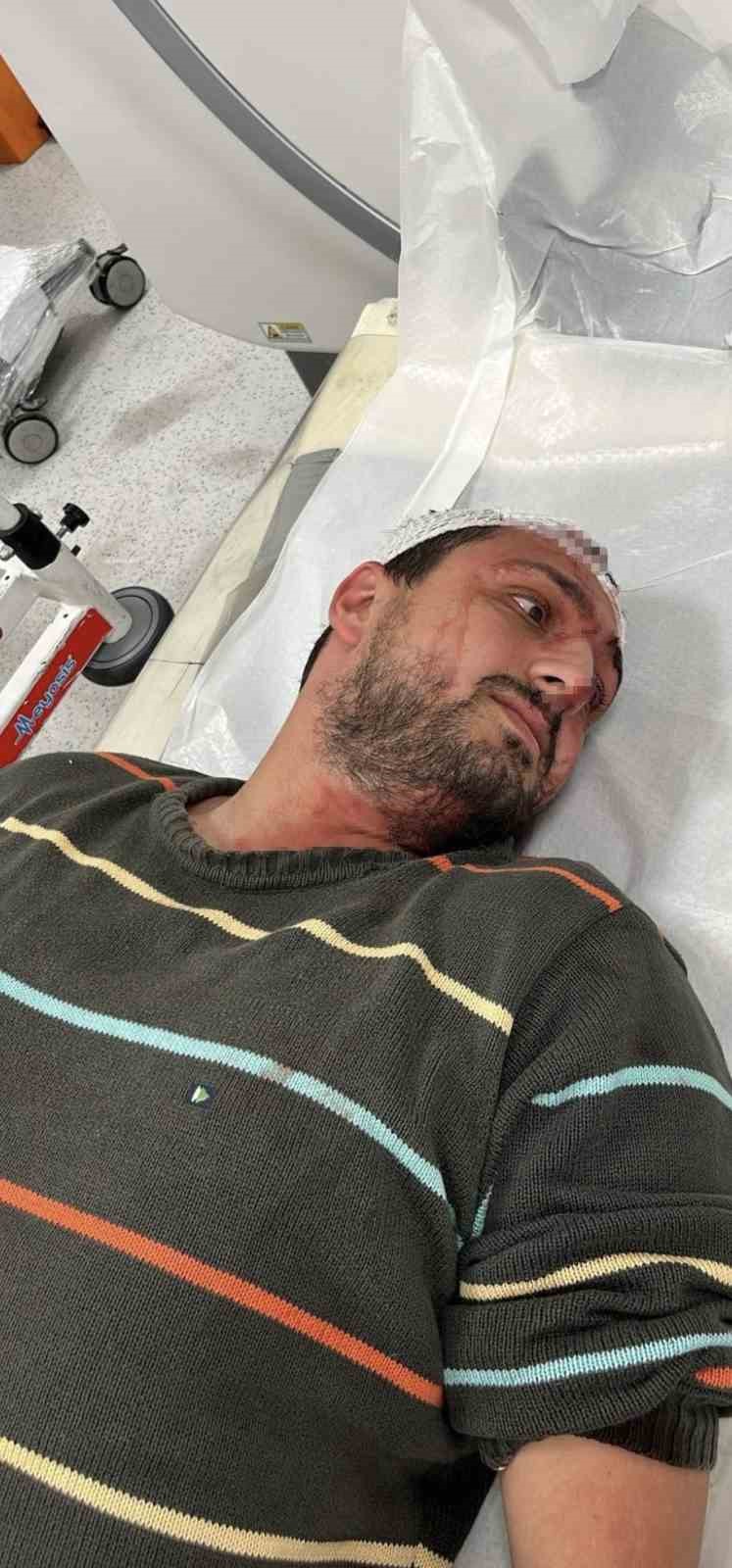 Yüzde 84 engeli bulunan adamı 30 dakika boyunca döven sanığın cezası belli oldu
