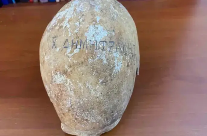 Türkiye’de ilk kez böyle bir kafatasına rastlandı