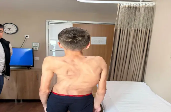 Kırgızistanlı genç şifayı Türk hekimlerinde buldu
