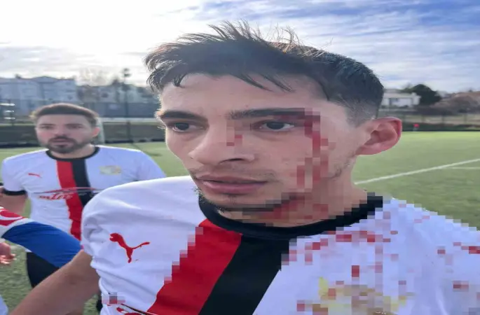 Maç sonrası saha içi savaş alanına döndü, 3 futbolcu hastanelik oldu
