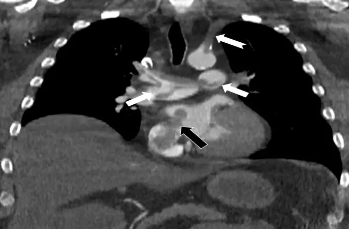 Tekden’de başarılı çalışmalara imza atan radyoloji uzmanından hayati tespit
